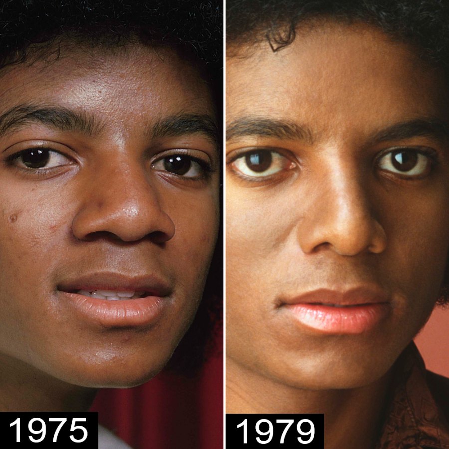 michaeljacksonfirstnosejob.jpg